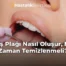 Diş Plağı Nasıl Oluşur, Ne Zaman Temizlenmeli?