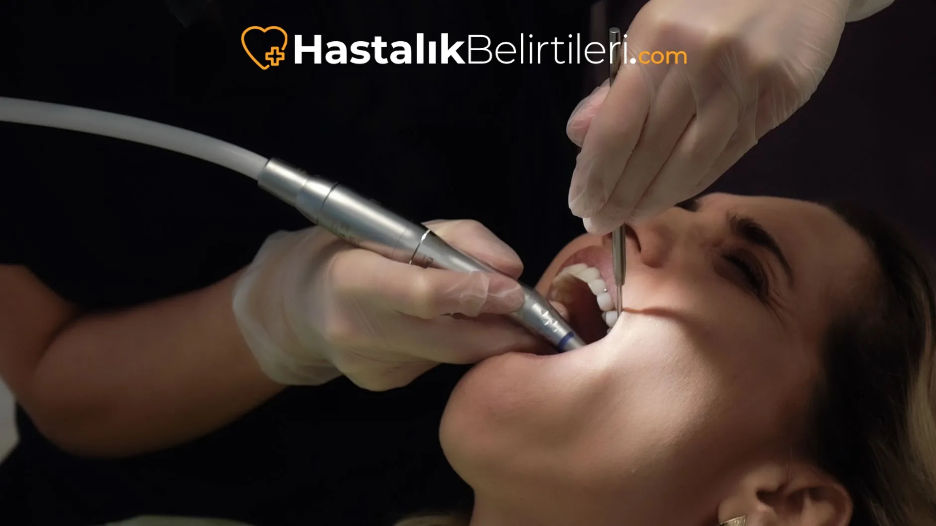 Diş Travması Sonrası Ne Yapılmalı? 4 Dişe darbe sonrası sütle ağız çalkalama ve saklama