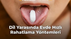 Dil Yarasında Evde Hızlı Rahatlama Yöntemleri