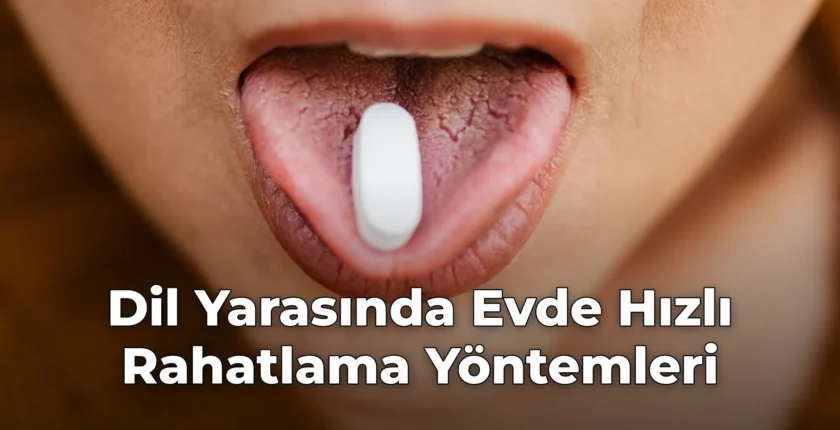 Dil Yarasında Evde Hızlı Rahatlama Yöntemleri