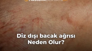 Diz dışı bacak ağrısı Neden Olur?