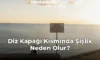 Diz Kapağı Kısmında Şişlik Neden Olur?
