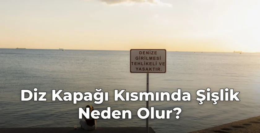 Diz Kapağı Kısmında Şişlik Neden Olur?