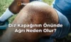 Diz Kapağının Önünde Ağrı Neden Olur?