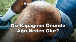 Diz Kapağının Önünde Ağrı Neden Olur?