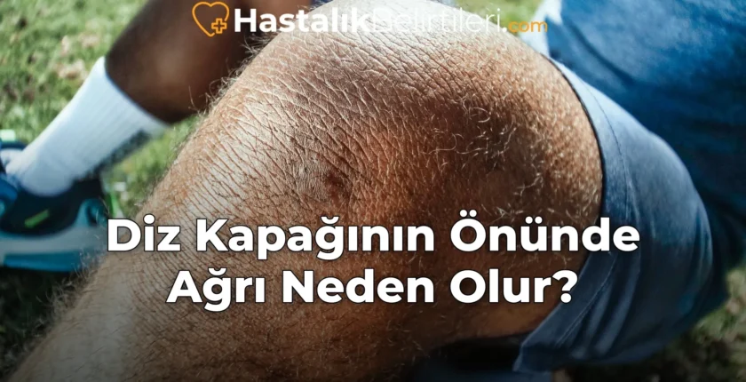 Diz Kapağının Önünde Ağrı Neden Olur?