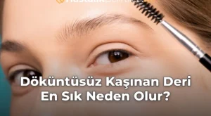 Döküntüsüz Kaşınan Deri En Sık Neden Olur?