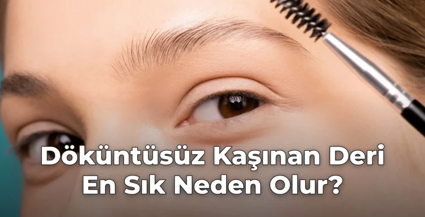 Döküntüsüz Kaşınan Deri En Sık Neden Olur?