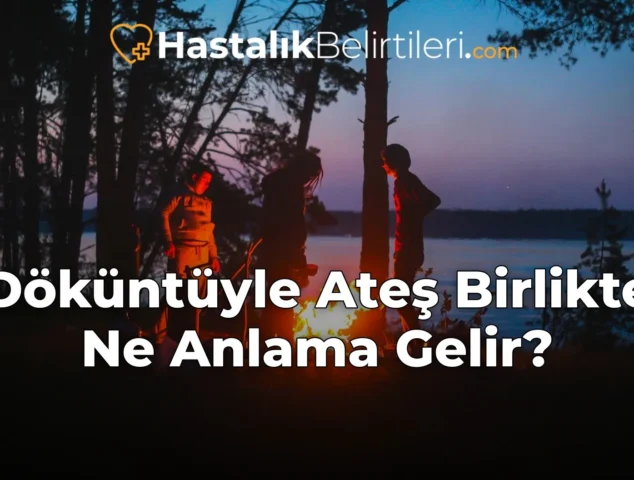 Döküntüyle Ateş Birlikte Ne Anlama Gelir?