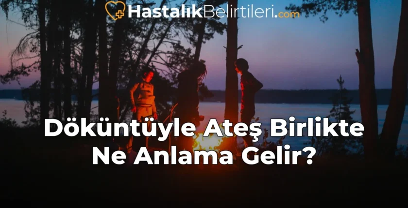 Döküntüyle Ateş Birlikte Ne Anlama Gelir?
