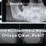 Çene Kilitlenmesi Neden Ortaya Çıkar, Peki?