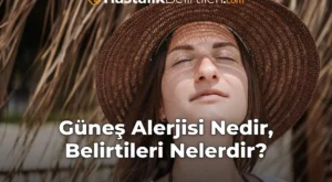 Güneş Alerjisi Nedir, Belirtileri Nelerdir?