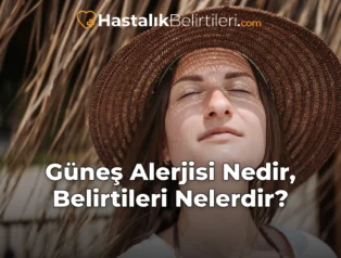Güneş Alerjisi Nedir, Belirtileri Nelerdir?