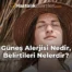 Güneş Alerjisi Nedir, Belirtileri Nelerdir?