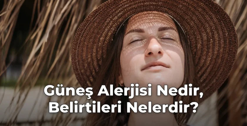 Güneş Alerjisi Nedir, Belirtileri Nelerdir?