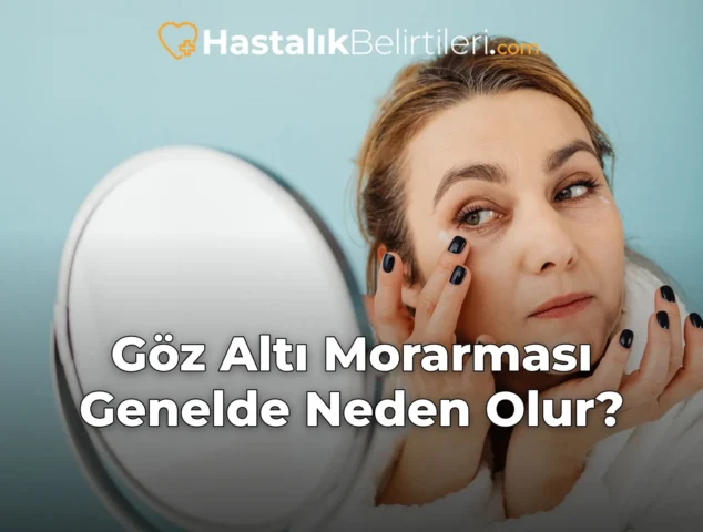 Göz Altı Morarması Genelde Neden Olur?