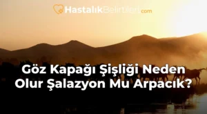 Göz Kapağı Şişliği Neden Olur Şalazyon Mu Arpacık?