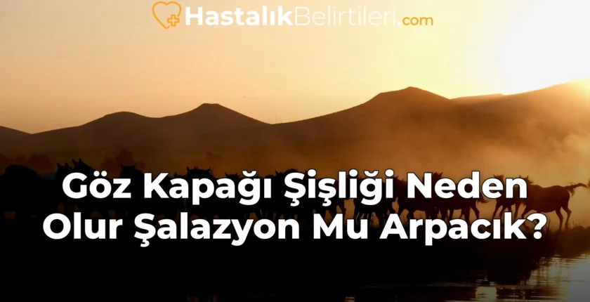 Göz Kapağı Şişliği Neden Olur Şalazyon Mu Arpacık?