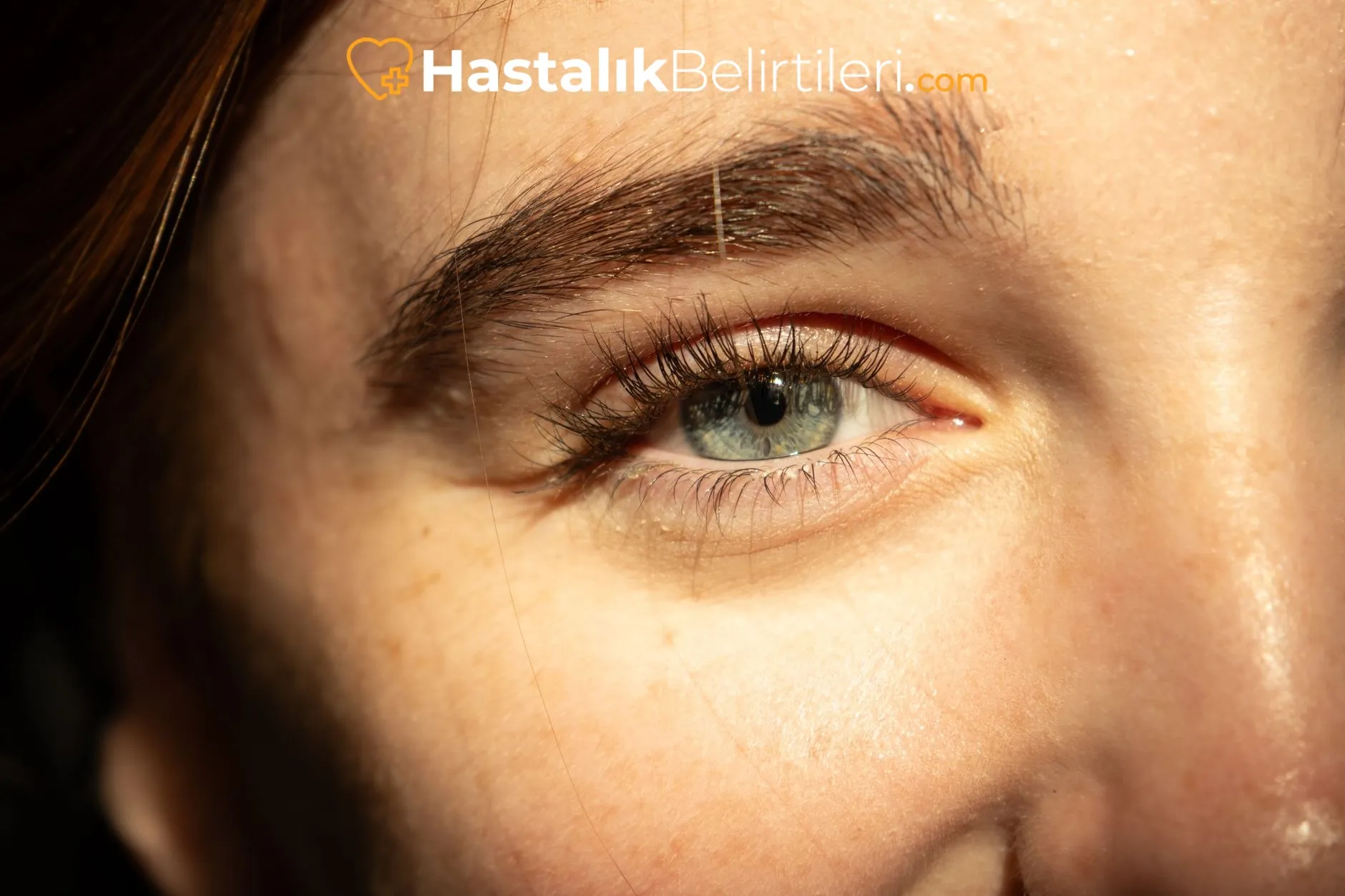 Göz Kapağı Şişmesi Neden Olur? 4 Soğuk kompres uygulayan kişi, göz kapağı şişliğini azaltma