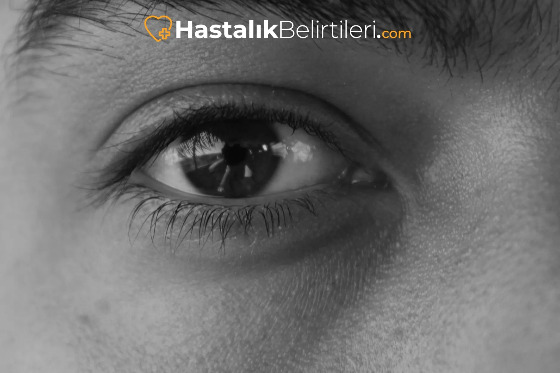 Göz Kapağı Şişmesi Neden Olur? 6 Evde göz kapağı şişmesi için dinlenme ve hijyen önerisi