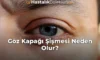 Göz Kapağı Şişmesi Neden Olur?