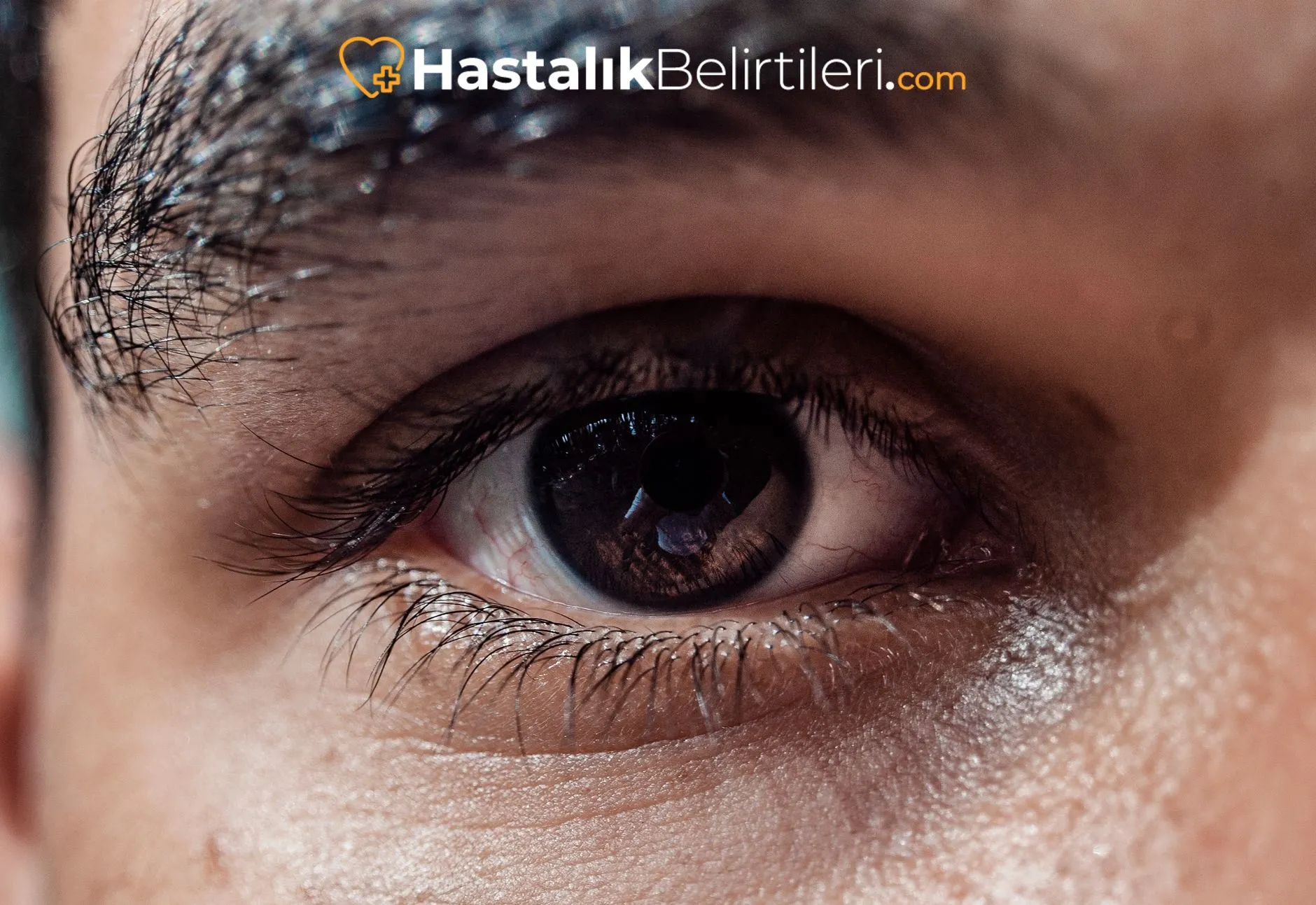 Gözde Işığa Hassasiyet Neden Olur? 4 Gözde ışığa hassasiyetin nedenleri ve olası hastalıklar