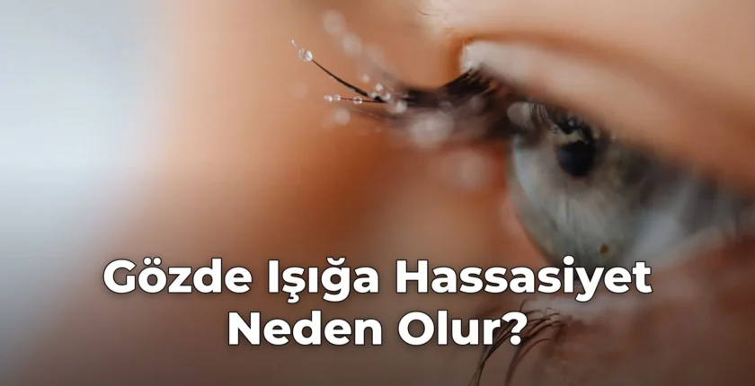 Gözde Işığa Hassasiyet Neden Olur?