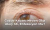 Gözde Kaşıntı Neden Olur Alerji Mi, Enfeksiyon Mu? Gözde Kaşıntı Neden Olur Alerji Mi, Enfeksiyon Mu?
