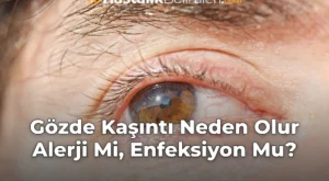 Gözde Kaşıntı Neden Olur Alerji Mi, Enfeksiyon Mu?