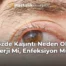 Gözde Kaşıntı Neden Olur Alerji Mi, Enfeksiyon Mu?