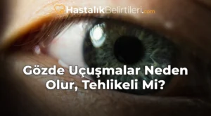 Gözde Uçuşmalar Neden Olur, Tehlikeli Mi?