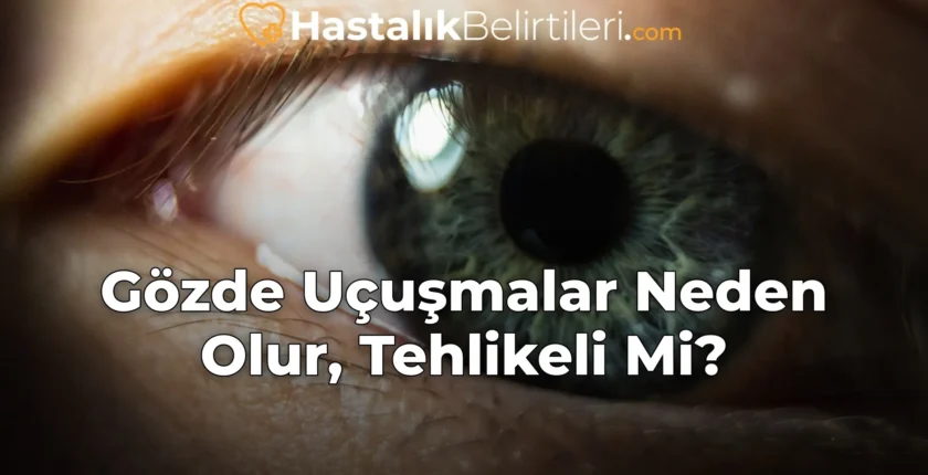 Gözde Uçuşmalar Neden Olur, Tehlikeli Mi?