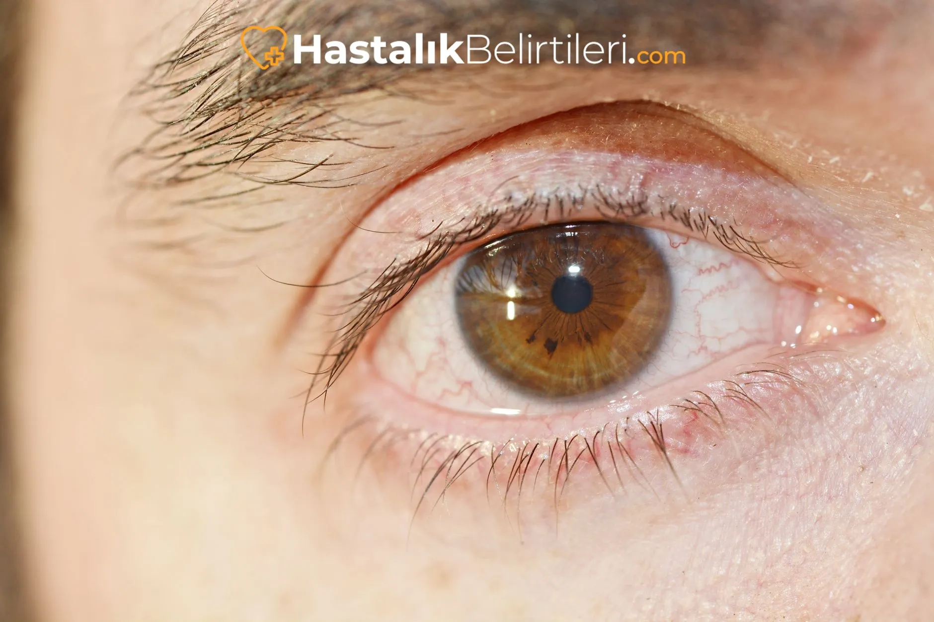 Kontakt lens takarken hijyen ve ellerin yıkanması