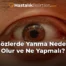 Gözlerde Yanma Neden Olur ve Ne Yapmalı?