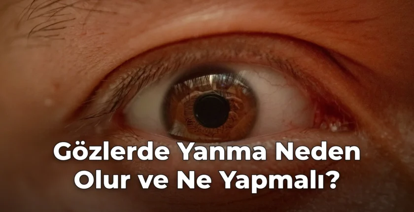 Gözlerde Yanma Neden Olur ve Ne Yapmalı?