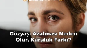 Gözyaşı Azalması Neden Olur, Kuruluk Farkı?