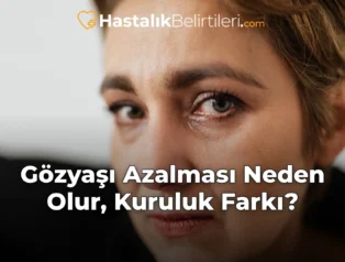 Gözyaşı Azalması Neden Olur, Kuruluk Farkı?