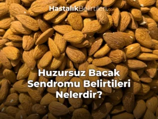 Huzursuz Bacak Sendromu Belirtileri Nelerdir?