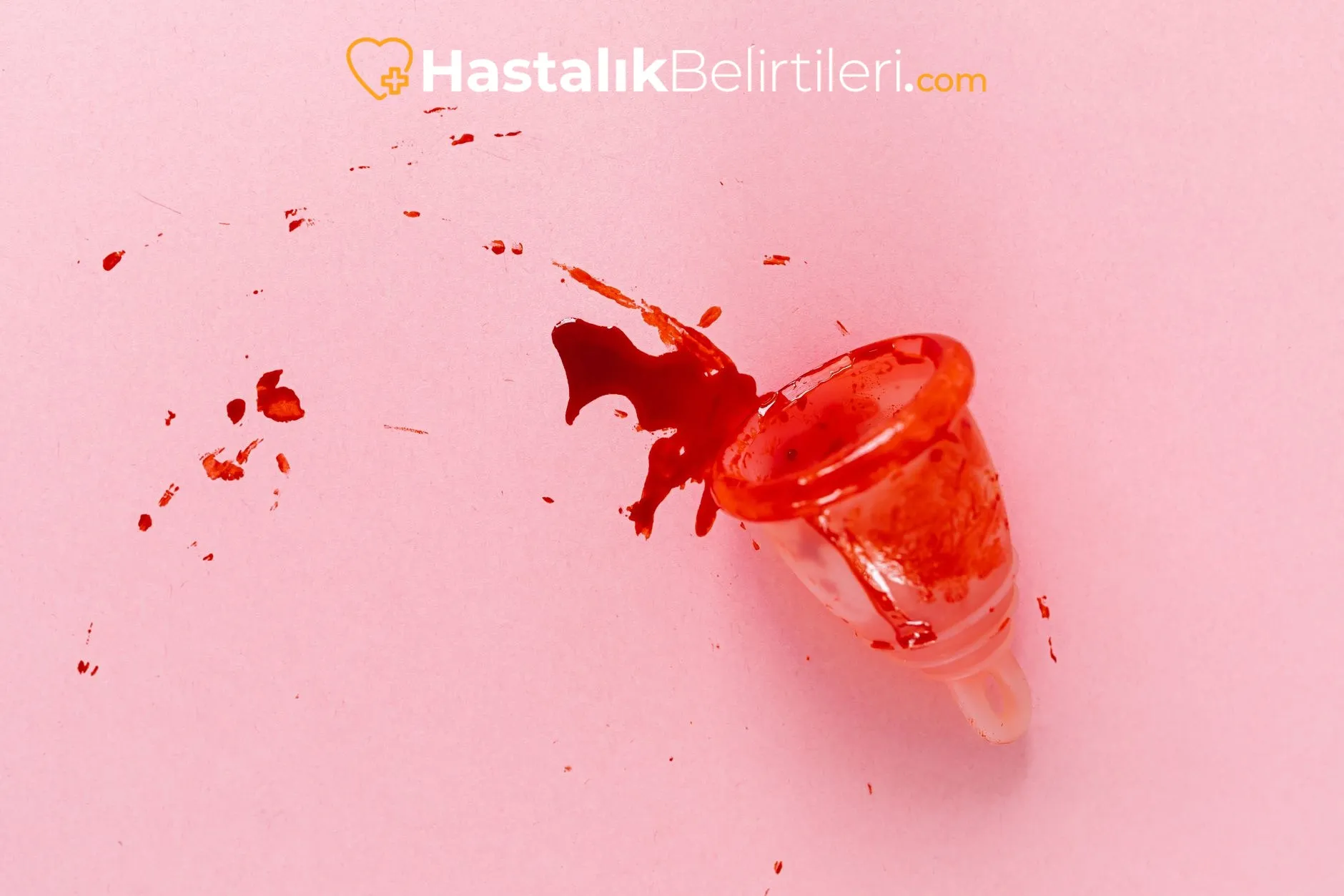 İdrarda Kan Gelmesi Neden Acildir? 2 i̇drarda kan gelmesi neden olur