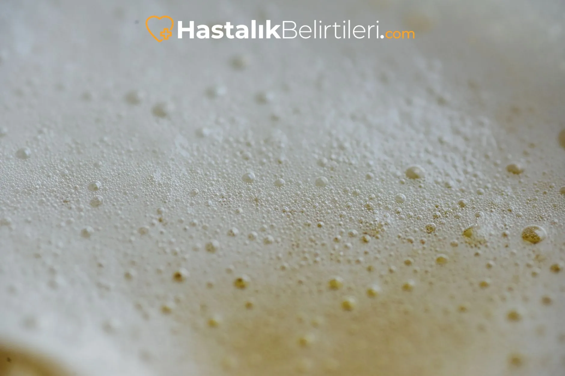 İdrarda Köpürme Neden Olur, Ne Zaman Test? 3 Köpüren idrarın yakın plan fotoğrafı, test zamanlaması