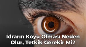 İdrarın Koyu Olması Neden Olur, Tetkik Gerekir Mi?