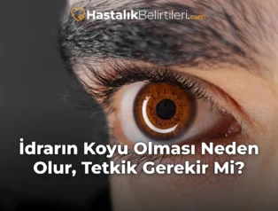 İdrarın Koyu Olması Neden Olur, Tetkik Gerekir Mi?