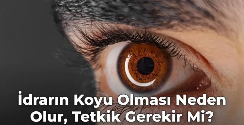 İdrarın Koyu Olması Neden Olur, Tetkik Gerekir Mi?