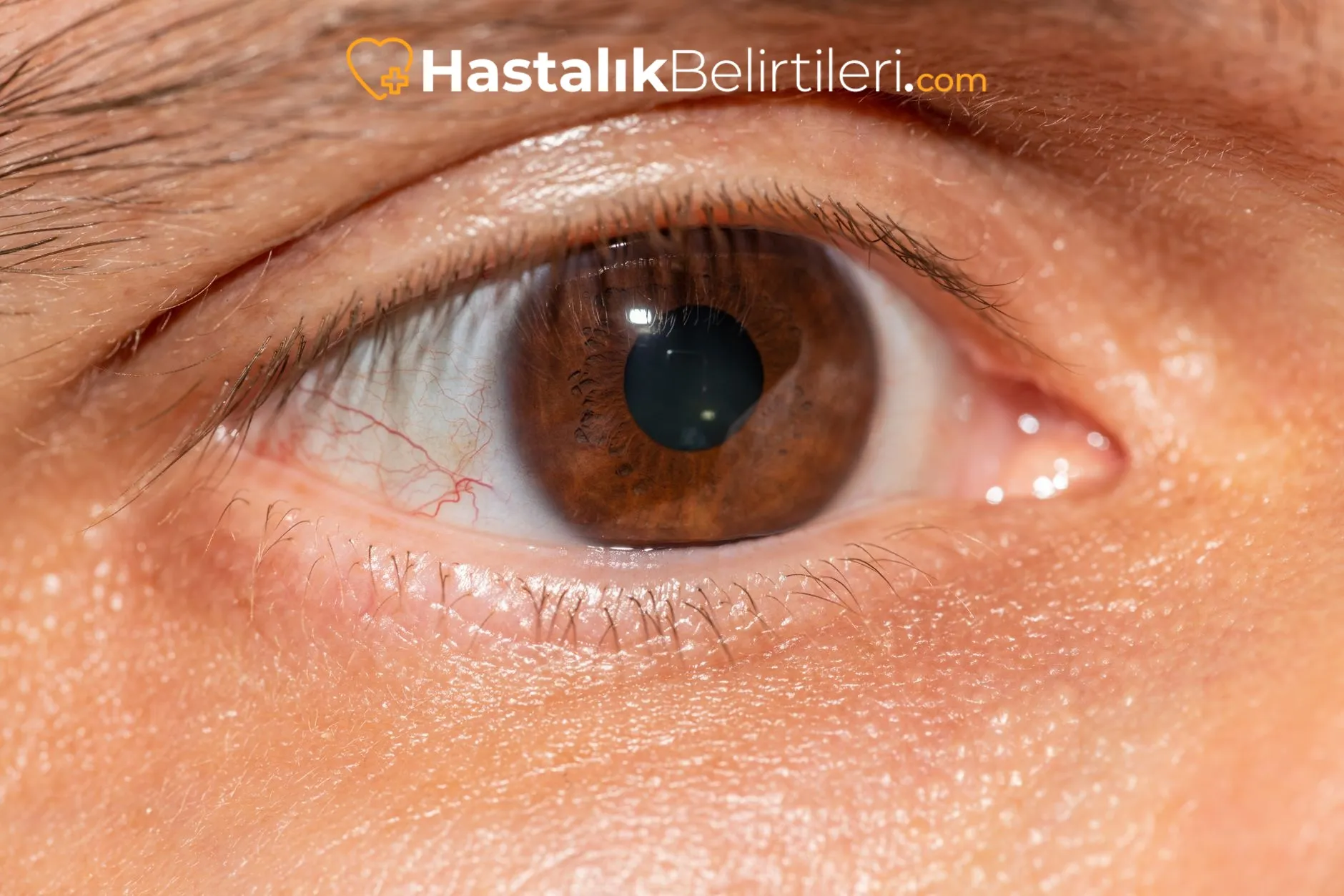 Katarakt Belirtileri Nelerdir, Kimler Dikkat Etmeli? 4 Yakın nesnelerde görme zorluğu: erken katarakt işaretleri