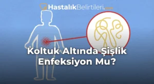 Koltuk Altında Şişlik Enfeksiyon Mu?