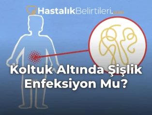 Koltuk Altında Şişlik Enfeksiyon Mu?