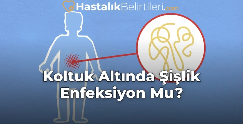 Koltuk Altında Şişlik Enfeksiyon Mu?