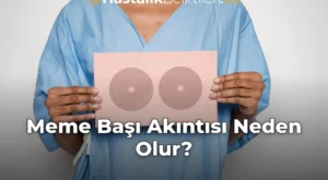 Meme Başı Akıntısı Neden Olur?