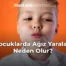 Çocuklarda Ağız Yaraları Neden Olur?
