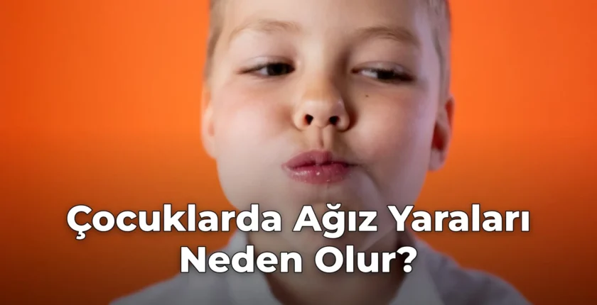 Çocuklarda Ağız Yaraları Neden Olur?